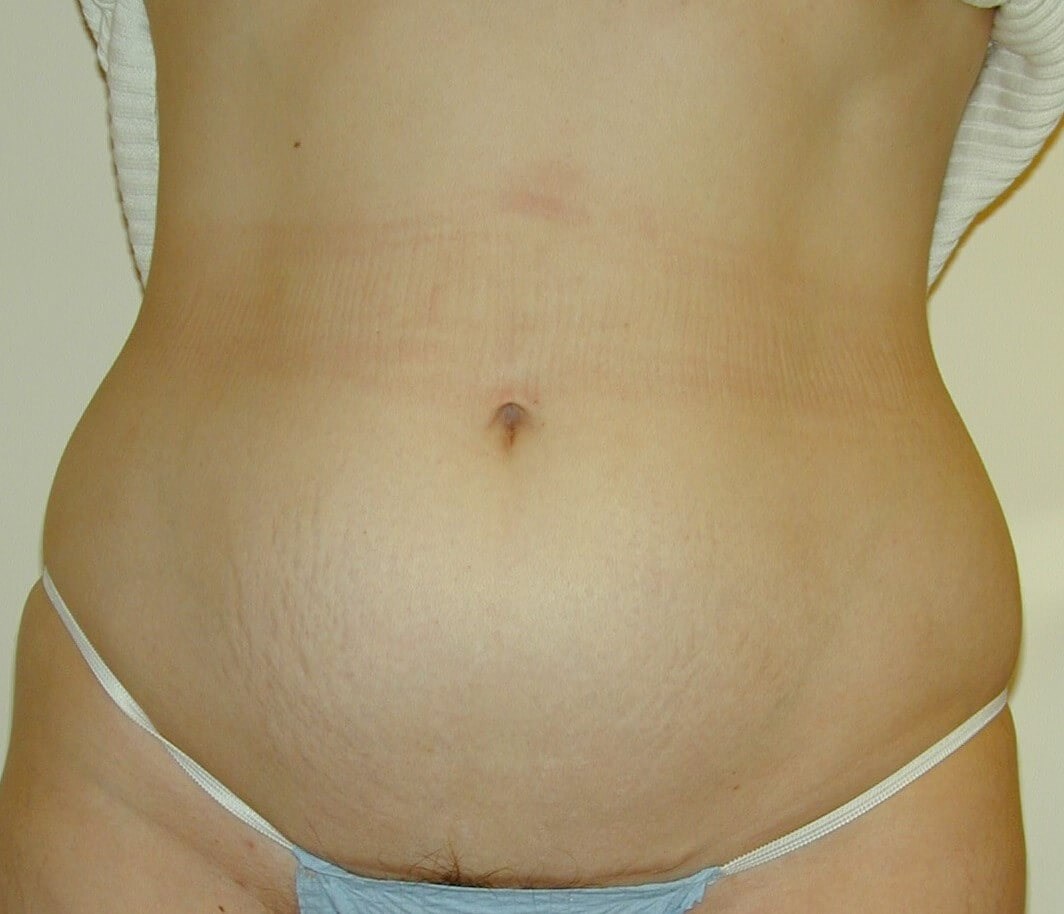 Before Image