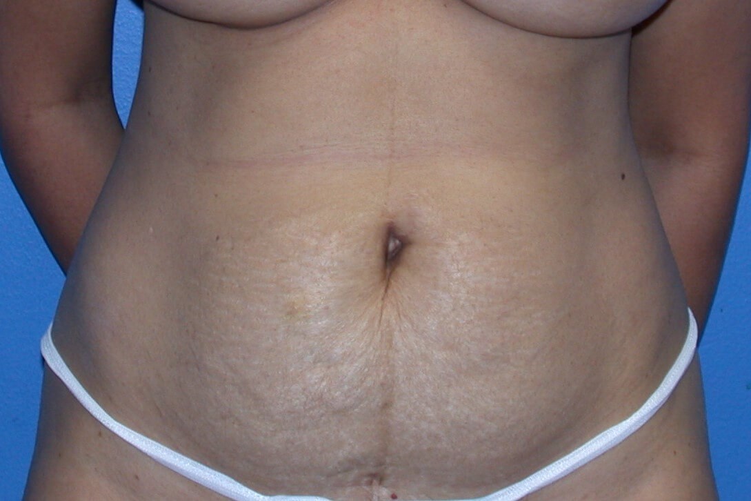 Before Image