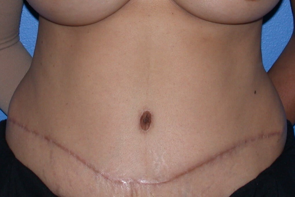 After Image