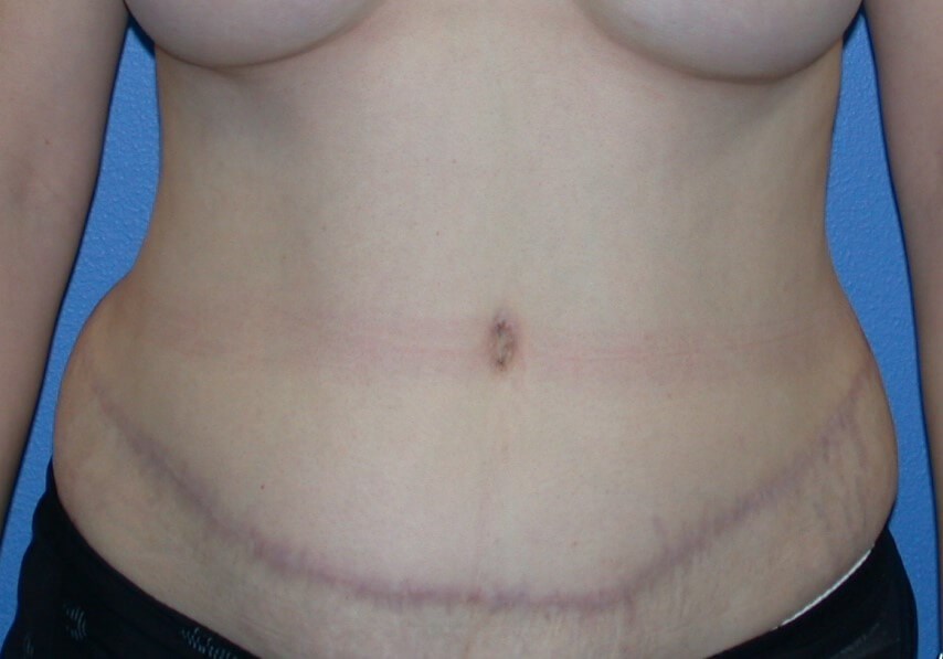 After Image