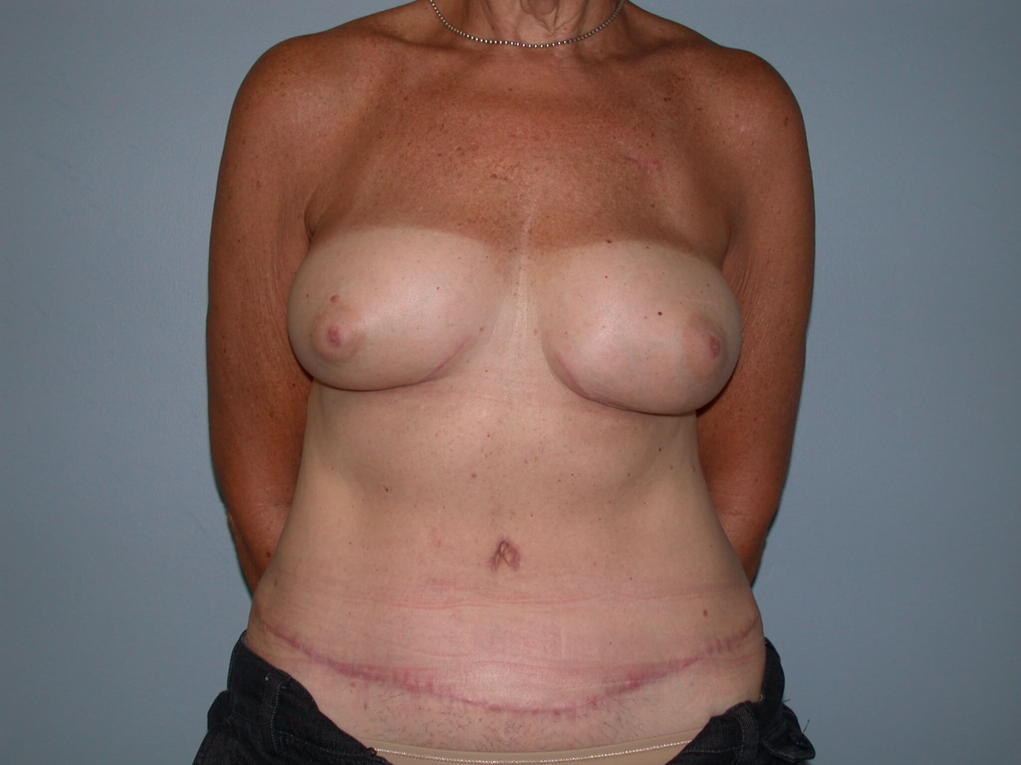 After Image